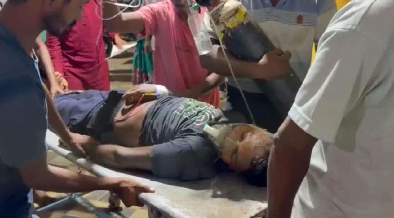 বজ্রপাতে লালগড়ে আহত ১৪ দর্শক, আশঙ্কাজনক ৪ জন!